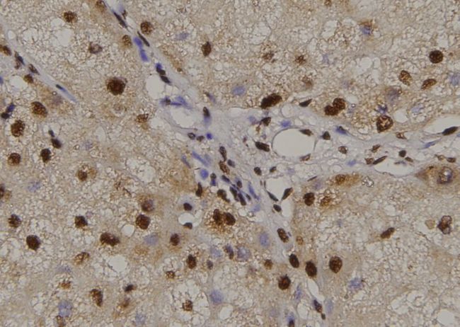 AML1 / RUNX1 Antibody - 1:100 staining human liver tissue by IHC-P. The sample was formaldehyde fixed and a heat mediated antigen retrieval step in citrate buffer was performed. The sample was then blocked and incubated with the antibody for 1.5 hours at 22°C. An HRP conjugated goat anti-rabbit antibody was used as the secondary.