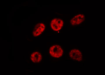 AML1 / RUNX1 Antibody - Staining HeLa cells by IF/ICC. The samples were fixed with PFA and permeabilized in 0.1% Triton X-100, then blocked in 10% serum for 45 min at 25°C. The primary antibody was diluted at 1:200 and incubated with the sample for 1 hour at 37°C. An Alexa Fluor 594 conjugated goat anti-rabbit IgG (H+L) Ab, diluted at 1/600, was used as the secondary antibody.