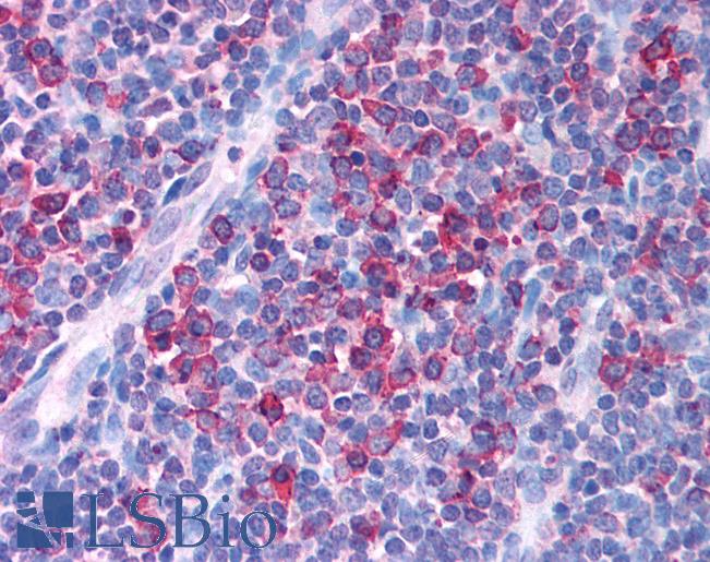 AML1 / RUNX1 Antibody - Anti-RUNX1 antibody IHC of human tonsil. Immunohistochemistry of formalin-fixed, paraffin-embedded tissue after heat-induced antigen retrieval. Antibody concentration 5 ug/ml.  This image was taken for the unconjugated form of this product. Other forms have not been tested.