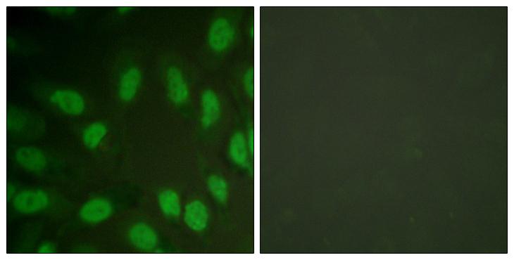 AML1 / RUNX1 Antibody - Peptide - + Immunofluorescence analysis of HeLa cells, using AML1 (Ab-303) Antibody.