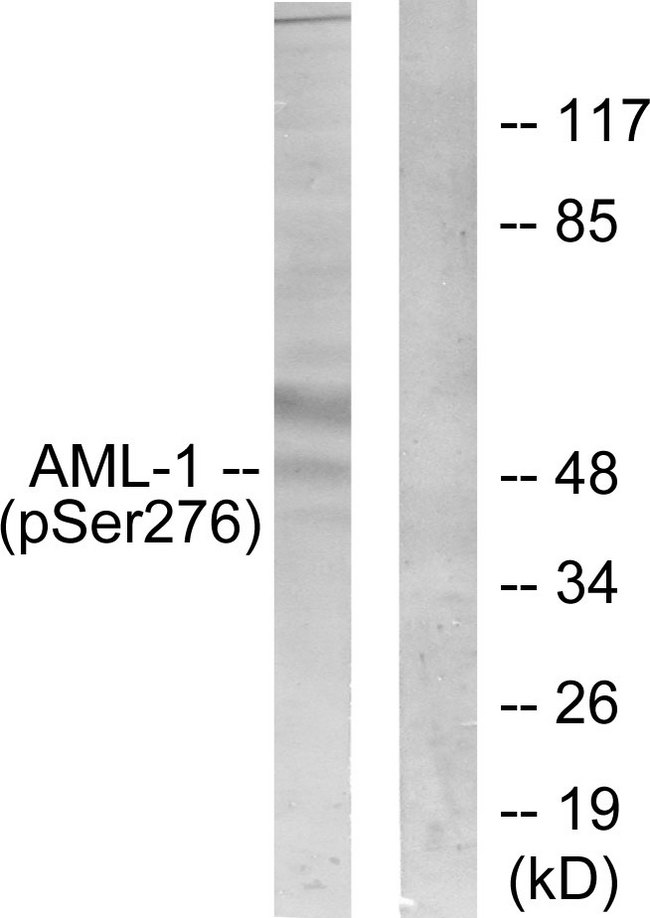 AML1 / RUNX1 Antibody - Western blot analysis of lysates from Jurkat cells, using AML1 (Phospho-Ser276) Antibody. The lane on the right is blocked with the phospho peptide.