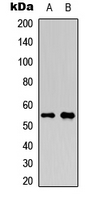 AML1 / RUNX1 Antibody - Western blot analysis of RUNX1 (pS276) expression in HeLa (A); HepG2 (B) whole cell lysates.