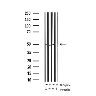 AML1 / RUNX1 Antibody - Western blot analysis of Phospho-AML1 (Ser276) expression in various lysates