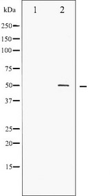 AML1 / RUNX1 Antibody - Western blot analysis of AML1 phosphorylation expression in Jurkat whole cells lysates. The lane on the left is treated with the antigen-specific peptide.