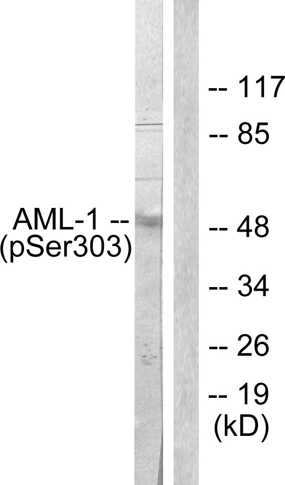 AML1 / RUNX1 Antibody - Western blot analysis of lysates from Jurkat cells, using AML1 (Phospho-Ser303) Antibody. The lane on the right is blocked with the phospho peptide.