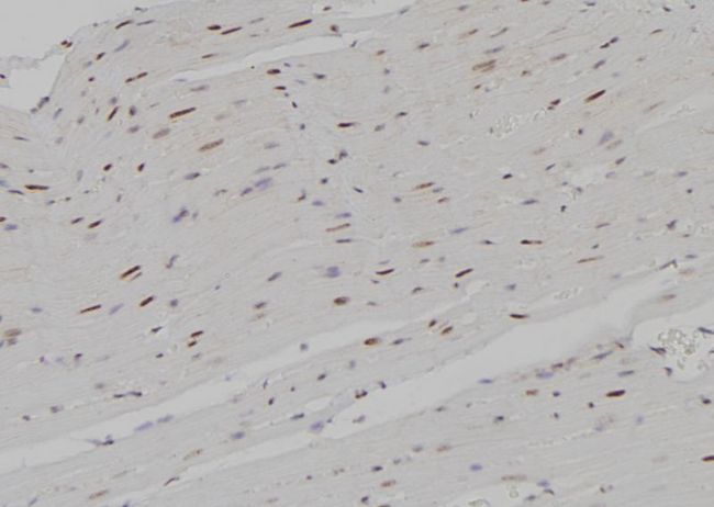 AML1 / RUNX1 Antibody - 1:100 staining rat heart tissue by IHC-P. The sample was formaldehyde fixed and a heat mediated antigen retrieval step in citrate buffer was performed. The sample was then blocked and incubated with the antibody for 1.5 hours at 22°C. An HRP conjugated goat anti-rabbit antibody was used as the secondary.