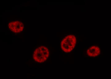 AML1 / RUNX1 Antibody - Staining HeLa cells by IF/ICC. The samples were fixed with PFA and permeabilized in 0.1% Triton X-100, then blocked in 10% serum for 45 min at 25°C. The primary antibody was diluted at 1:200 and incubated with the sample for 1 hour at 37°C. An Alexa Fluor 594 conjugated goat anti-rabbit IgG (H+L) Ab, diluted at 1/600, was used as the secondary antibody.