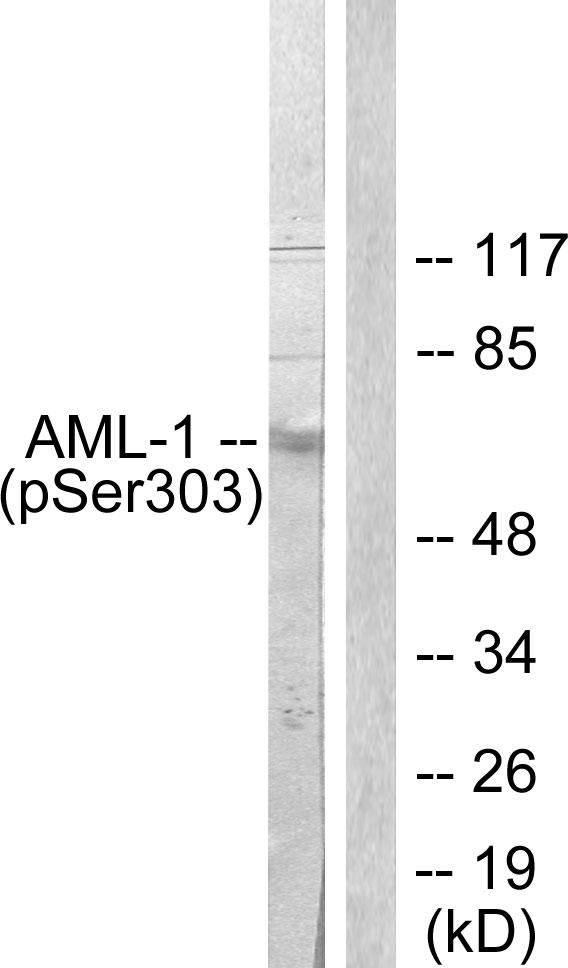 AML1 / RUNX1 Antibody - Western blot analysis of extracts from Jurkat cells, using AML1 (Phospho-Ser303) Antibody.