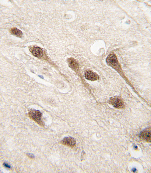 AML1 / RUNX1 Antibody - Formalin-fixed and paraffin-embedded human brain tissue reacted with RUNX1 Antibody (S276) , which was peroxidase-conjugated to the secondary antibody, followed by DAB staining. This data demonstrates the use of this antibody for immunohistochemistry; clinical relevance has not been evaluated.