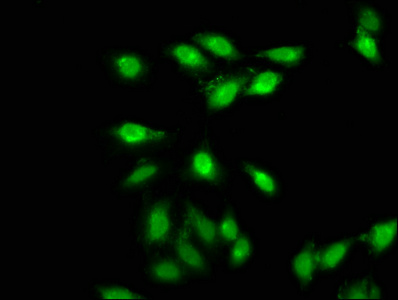 AMMECR1 Antibody - Immunofluorescence staining of Hela cells at a dilution of 1:66, counter-stained with DAPI. The cells were fixed in 4% formaldehyde, permeabilized using 0.2% Triton X-100 and blocked in 10% normal Goat Serum. The cells were then incubated with the antibody overnight at 4 °C.The secondary antibody was Alexa Fluor 488-congugated AffiniPure Goat Anti-Rabbit IgG (H+L) .
