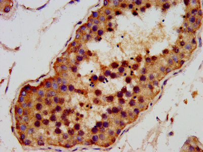 AMMECR1 Antibody - Immunohistochemistry image at a dilution of 1:200 and staining in paraffin-embedded human testis tissue performed on a Leica BondTM system. After dewaxing and hydration, antigen retrieval was mediated by high pressure in a citrate buffer (pH 6.0) . Section was blocked with 10% normal goat serum 30min at RT. Then primary antibody (1% BSA) was incubated at 4 °C overnight. The primary is detected by a biotinylated secondary antibody and visualized using an HRP conjugated SP system.