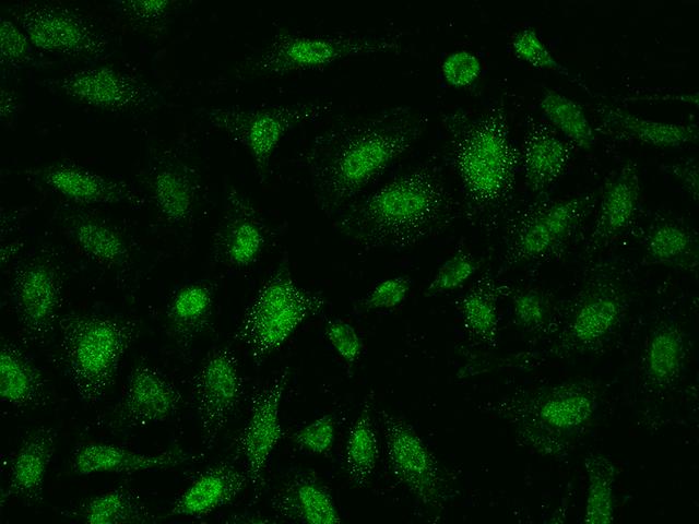 AMMECR1 Antibody - Immunofluorescence staining of AMMECR1 in HeLa cells. Cells were fixed with 4% PFA, permeabilzed with 0.1% Triton X-100 in PBS, blocked with 10% serum, and incubated with rabbit anti-Human AMMECR1 polyclonal antibody (dilution ratio 1:200) at 4°C overnight. Then cells were stained with the Alexa Fluor 488-conjugated Goat Anti-rabbit IgG secondary antibody (green). Positive staining was localized to Nucleus and Cytoplasm.