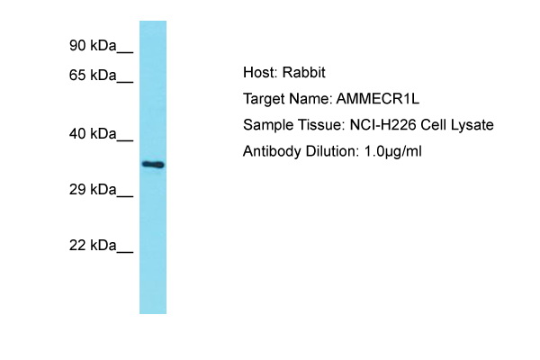 AMMECR1L Antibody -  This image was taken for the unconjugated form of this product. Other forms have not been tested.