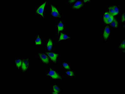 AMN Antibody - Immunofluorescence staining of Hela cells diluted at 1:200, counter-stained with DAPI. The cells were fixed in 4% formaldehyde, permeabilized using 0.2% Triton X-100 and blocked in 10% normal Goat Serum. The cells were then incubated with the antibody overnight at 4°C.The Secondary antibody was Alexa Fluor 488-congugated AffiniPure Goat Anti-Rabbit IgG (H+L).