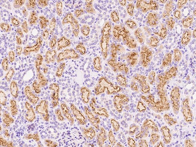 AMN Antibody - Immunochemical staining of human AMN in human kidney with rabbit polyclonal antibody at 1:1000 dilution, formalin-fixed paraffin embedded sections.