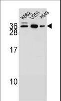 AMN1 Antibody - AMN1 Antibody western blot of K562,U251,A549 cell line lysates (35 ug/lane). The AMN1 antibody detected the AMN1 protein (arrow).