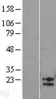 AMN1 Protein - Western validation with an anti-DDK antibody * L: Control HEK293 lysate R: Over-expression lysate