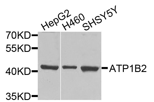 AMOG / ATP1B2 Antibody - Western blot analysis of extracts of various cells.