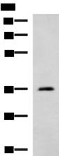 AMOG / ATP1B2 Antibody - Western blot analysis of Human cerebella tissue lysate  using ATP1B2 Polyclonal Antibody at dilution of 1:650