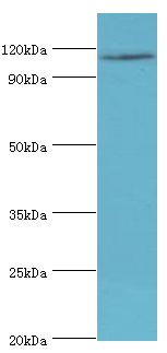AMOT / Angiomotin Antibody - Western blot. All lanes: Angiomotin antibody at 2 ug/ml+293T whole cell lysate. Secondary antibody: Goat polyclonal to rabbit at 1:10000 dilution. Predicted band size: 118 kDa. Observed band size: 118 kDa.