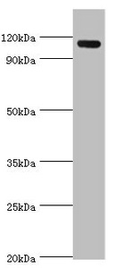 AMOT / Angiomotin Antibody - Western blot All lanes: Angiomotin antibody at 2µg/ml + 293T whole cell lysate Secondary Goat polyclonal to rabbit IgG at 1/10000 dilution Predicted band size: 119, 73 kDa Observed band size: 119 kDa