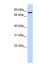 AMOT / Angiomotin Antibody - AMOT / Angiomotin antibody Western blot of Fetal Heart lysate. This image was taken for the unconjugated form of this product. Other forms have not been tested.