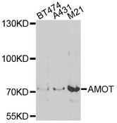 AMOT / Angiomotin Antibody - Western blot analysis of extracts of various cells.