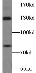 AMOT / Angiomotin Antibody - HEK293 cells were subjected to SDS PAGE followed by western blot with AMOT antibody at dilution of 1:1000
