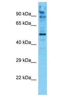 AMPD1 Antibody - AMPD1 / MAD antibody Western Blot of 293T. Antibody dilution: 1 ug/ml.  This image was taken for the unconjugated form of this product. Other forms have not been tested.