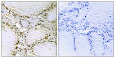 AMPD1 Antibody - Immunohistochemistry analysis of paraffin-embedded human thyroid gland tissue, using AMPD1 Antibody. The picture on the right is blocked with the synthesized peptide.