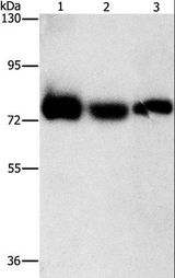 AMPD1 Antibody - Western blot analysis of Human fetal muscle tissue, K562 and HeLa cell, using AMPD1 Polyclonal Antibody at dilution of 1:1600.