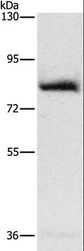 AMPD1 Antibody - Western blot analysis of Human fetal muscle tissue, using AMPD1 Polyclonal Antibody at dilution of 1:1600.