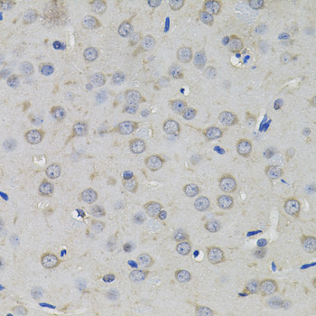 AMPD1 Antibody - Immunohistochemistry of paraffin-embedded rat brain tissue.