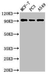 AMPD1 Antibody - Positive Western Blot detected in MCF-7 whole cell lysate, PC3 whole cell lysate, A549 whole cell lysate. All lanes: AMPD1 antibody at 3 µg/ml Secondary Goat polyclonal to rabbit IgG at 1/50000 dilution. Predicted band size: 91, 90 KDa. Observed band size: 91 KDa