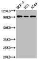 AMPD1 Antibody - Positive Western Blot detected in MCF-7 whole cell lysate, PC3 whole cell lysate, A549 whole cell lysate. All lanes: AMPD1 antibody at 3 µg/ml Secondary Goat polyclonal to rabbit IgG at 1/50000 dilution. Predicted band size: 91, 90 KDa. Observed band size: 91 KDa