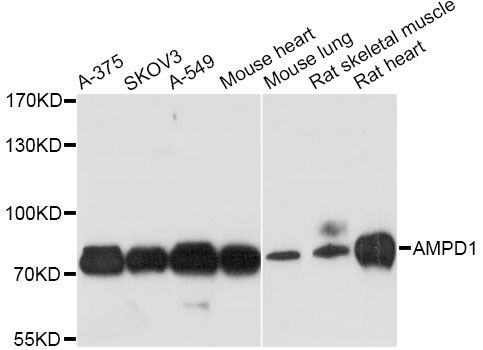 AMPD1 Antibody - Western blot analysis of extracts of various cell lines, using AMPD1 antibody at 1:3000 dilution. The secondary antibody used was an HRP Goat Anti-Rabbit IgG (H+L) at 1:10000 dilution. Lysates were loaded 25ug per lane and 3% nonfat dry milk in TBST was used for blocking. An ECL Kit was used for detection and the exposure time was 90s.