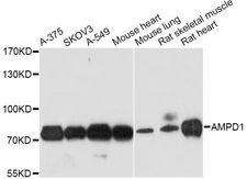 AMPD1 Antibody - Western blot analysis of extracts of various cell lines, using AMPD1 antibody at 1:3000 dilution. The secondary antibody used was an HRP Goat Anti-Rabbit IgG (H+L) at 1:10000 dilution. Lysates were loaded 25ug per lane and 3% nonfat dry milk in TBST was used for blocking. An ECL Kit was used for detection and the exposure time was 90s.