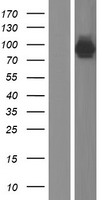AMPD1 Protein - Western validation with an anti-DDK antibody * L: Control HEK293 lysate R: Over-expression lysate