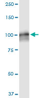 AMPD2 Antibody - AMPD2 monoclonal antibody (M09), clone 6A8. Western blot of AMPD2 expression in human kidney.