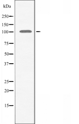 AMPD2 Antibody - Western blot analysis of extracts of HeLa cells using AMPD2 antibody.
