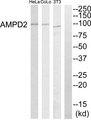 AMPD2 Antibody - Western blot analysis of extracts from HeLa cells, NIH-3T3 cells and COLO205 cells, using AMPD2 antibody.