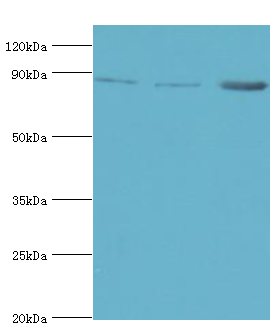 AMPD3 Antibody - Western blot. All lanes: AMP deaminase 3 antibody at 2 ug/ml. Lane 1: NIH3T3 whole cell lysate. Lane 2: 293T whole cell lysate. Lane 3: mouse lung tissue. secondary Goat polyclonal to rabbit at 1:10000 dilution. Predicted band size: 89 kDa. Observed band size: 89 kDa.