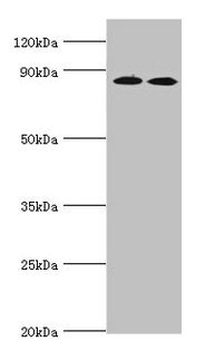 AMPD3 Antibody - Western blot All lanes: AMP deaminase 3 antibody at 2µg/ml Lane 1: NIH/3T3 whole cell lysate Lane 2: 293T whole cell lysate Lane 3: Mouse lung tissue Secondary Goat polyclonal to rabbit IgG at 1/10000 dilution Predicted band size: 89, 25, 77, 90, 72 kDa Observed band size: 89 kDa