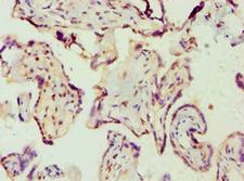 AMPD3 Antibody - Immunohistochemistry of paraffin-embedded human placenta using antibody at 1:100 dilution.