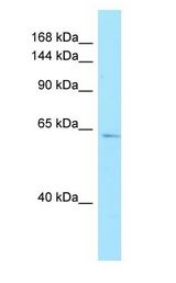 AMPD3 Antibody - AMPD3 antibody Western Blot of Placenta.  This image was taken for the unconjugated form of this product. Other forms have not been tested.