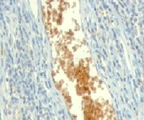 AMPD3 Antibody - Formalin-fixed, paraffin-embedded human tonsil stained with AMPD3 antibody (clone ETAD3-1).  This image was taken for the unmodified form of this product. Other forms have not been tested.