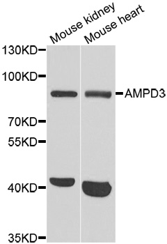 AMPD3 Antibody - Western blot analysis of extracts of various cell lines.