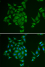 AMPD3 Antibody - Immunofluorescence analysis of HeLa cells.