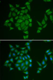 AMPD3 Antibody - Immunofluorescence analysis of HeLa cells.