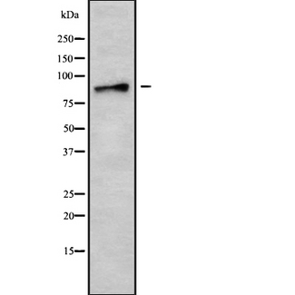 AMPD3 Antibody - Western blot analysis of AMPD3 using MCF-7 whole cells lysates